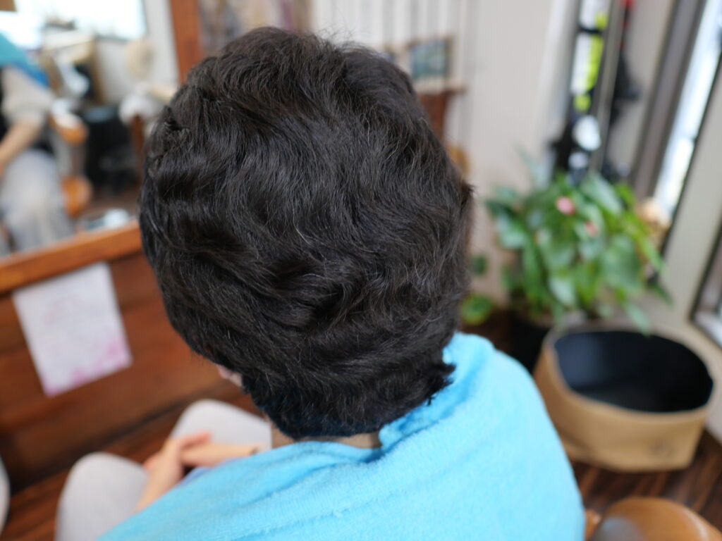 抗がん剤治療で脱毛　新しく生えてきた髪が超癖毛!!