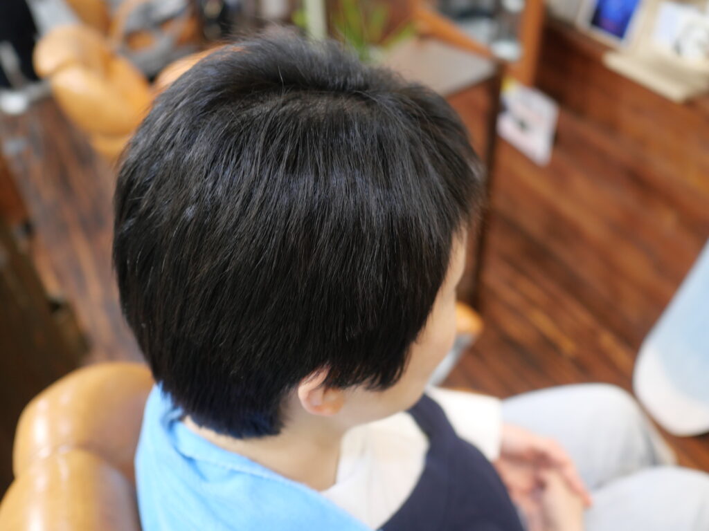 抗がん剤で脱毛　縮毛矯正でストレートヘアに