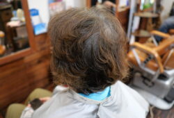 抗がん剤治療で脱毛